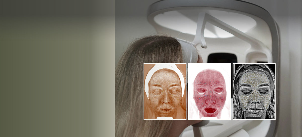 A VISIA skin scan at Eltham Cosmetic Clinic, with three scan results