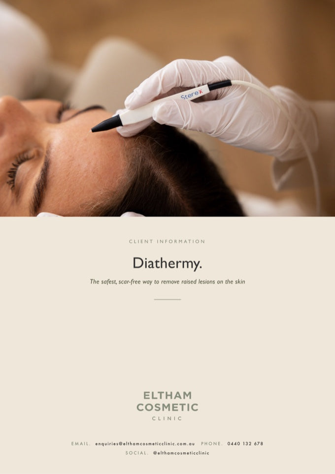 ECC Diathermy information pack
