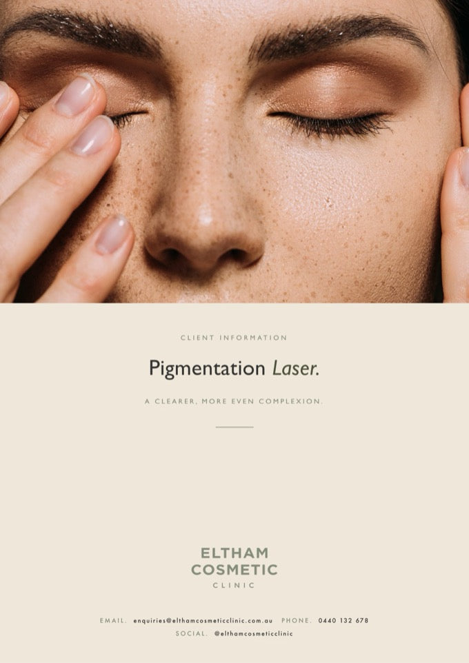 ECC Pigmentation Laser information pack