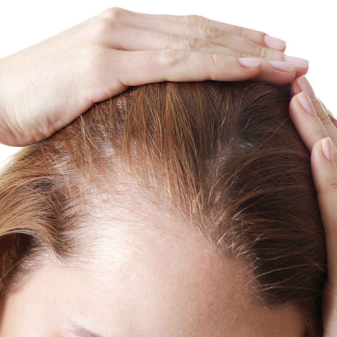 Tired of Losing Hair?