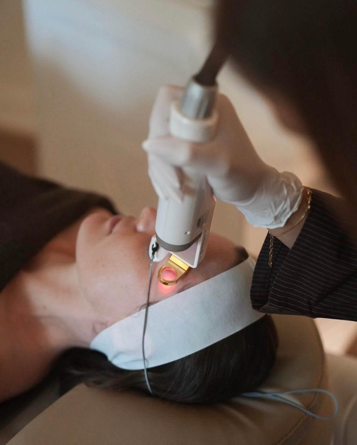 Laser Genesis treatment with the Cutera excel V+ at Eltham Cosmetic Clinic