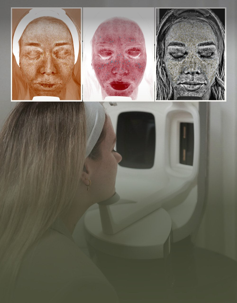 A VISIA skin scan at Eltham Cosmetic Clinic, with three scan results