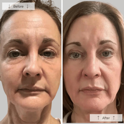 OmniLux Contour Face Mask