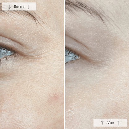 OmniLux Contour Face Mask