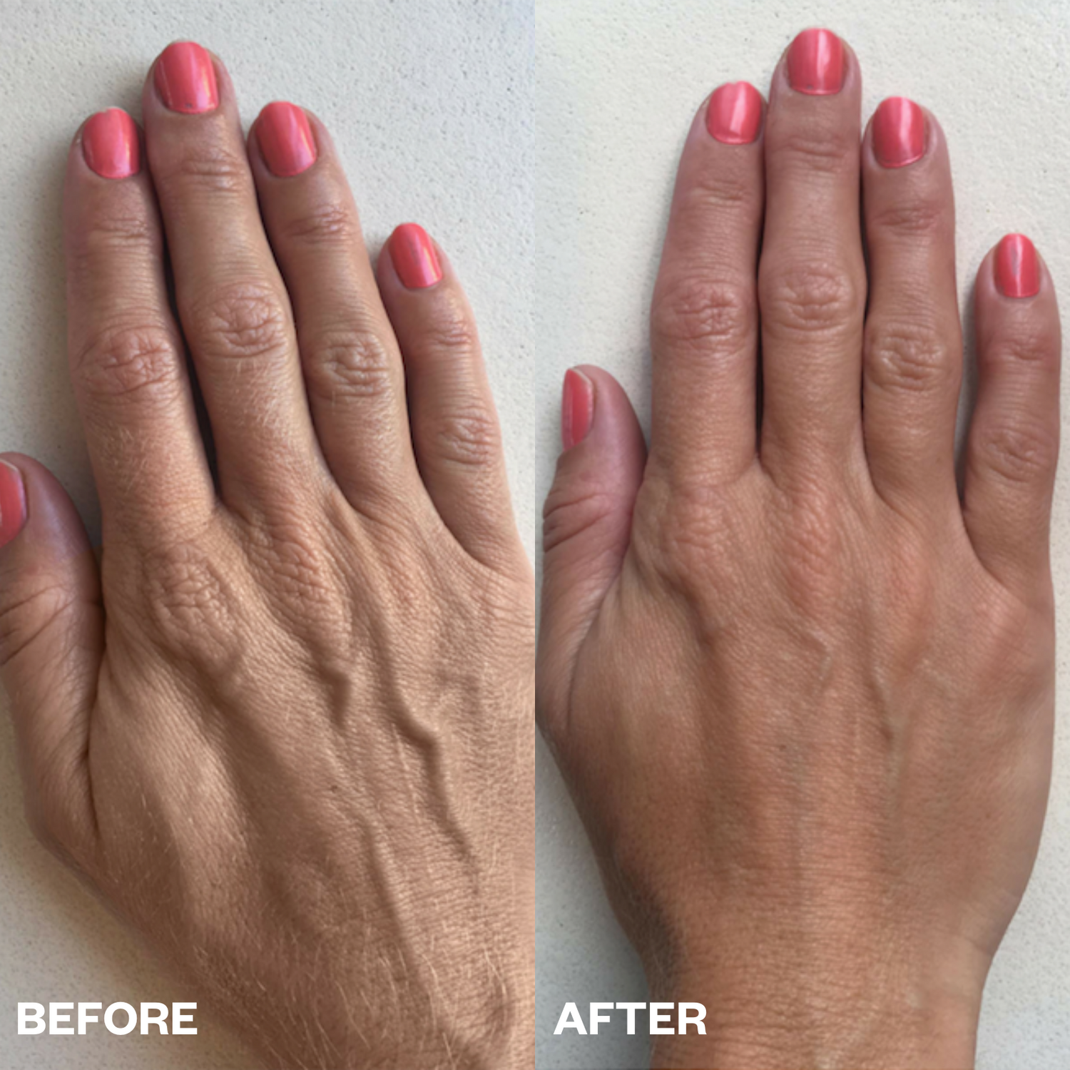 Hand Smoothing Kit