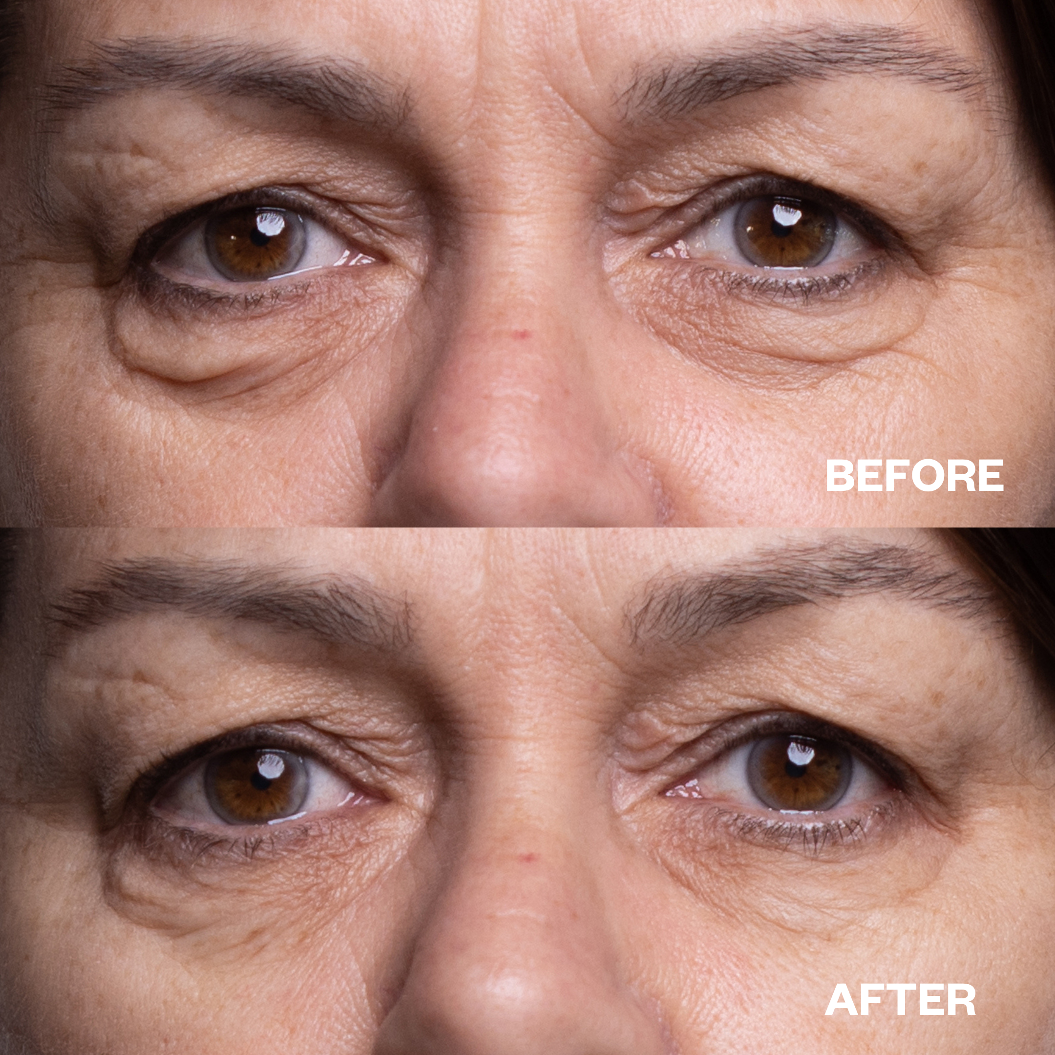 Eye Smoothing Kit