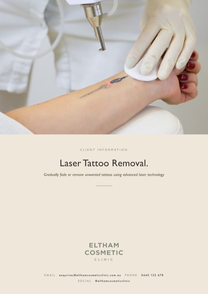 ECC Laser Tattoo Removal information pack