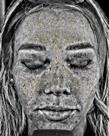 VISIA UV damage scan